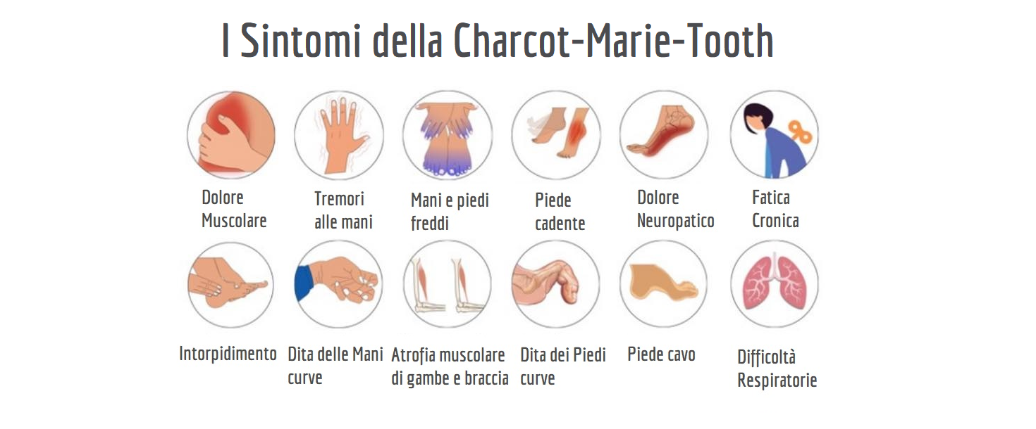 ACMTRete per la malattia di CharcotMarieTooth OdV, dona ora su Wishraiser
